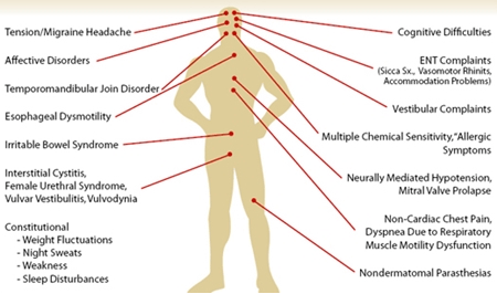 7 Common Types Of Fibromyalgia Pain