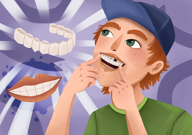 How To Take Care Of Your Veneers