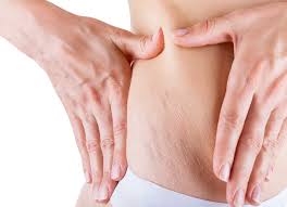 6 Anti-Cellulite Treatments At Home 2019 6 Anti-Cellulite Treatments At Home 2019