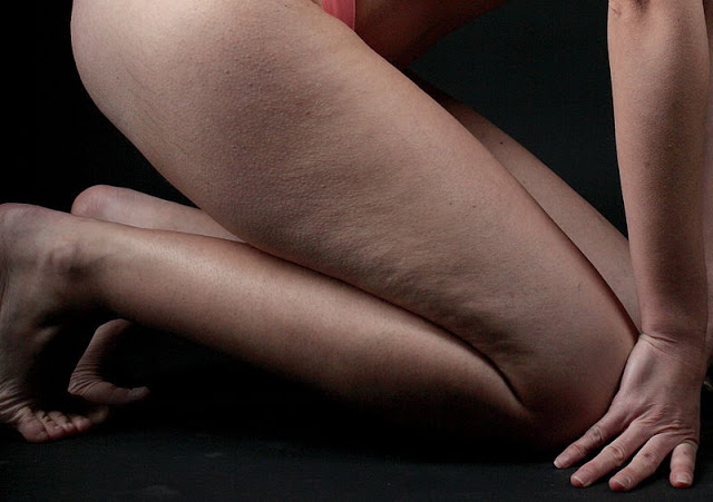 Effective Ways To Reduce The Appearance Of Cellulite